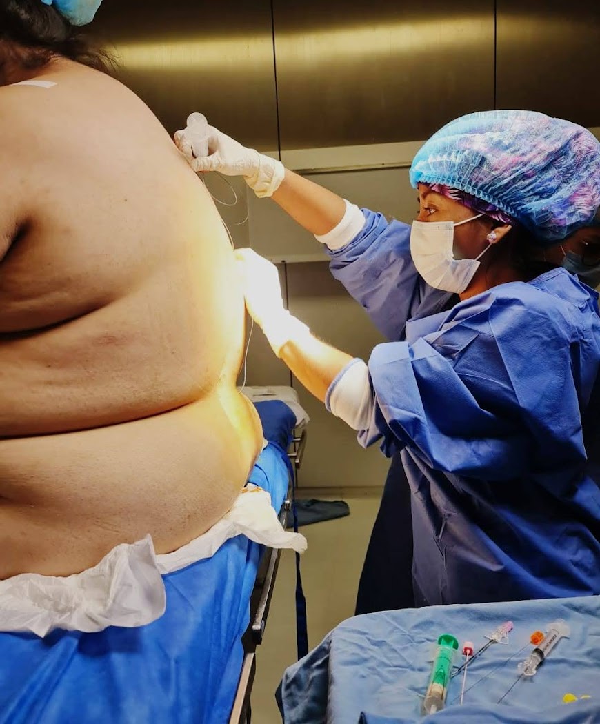 Procedimiento de bloqueo nervioso